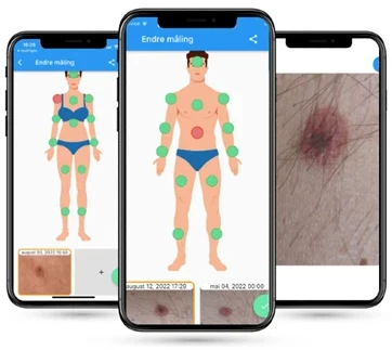 3-telefoner-mole-v4 3-telefoner-mole-v4